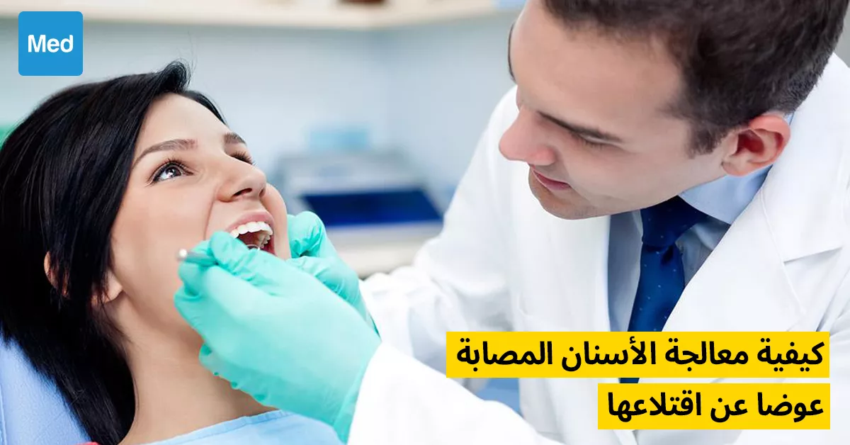 كيفية معالجة الأسنان المصابة عوضا عن اقتلاعها